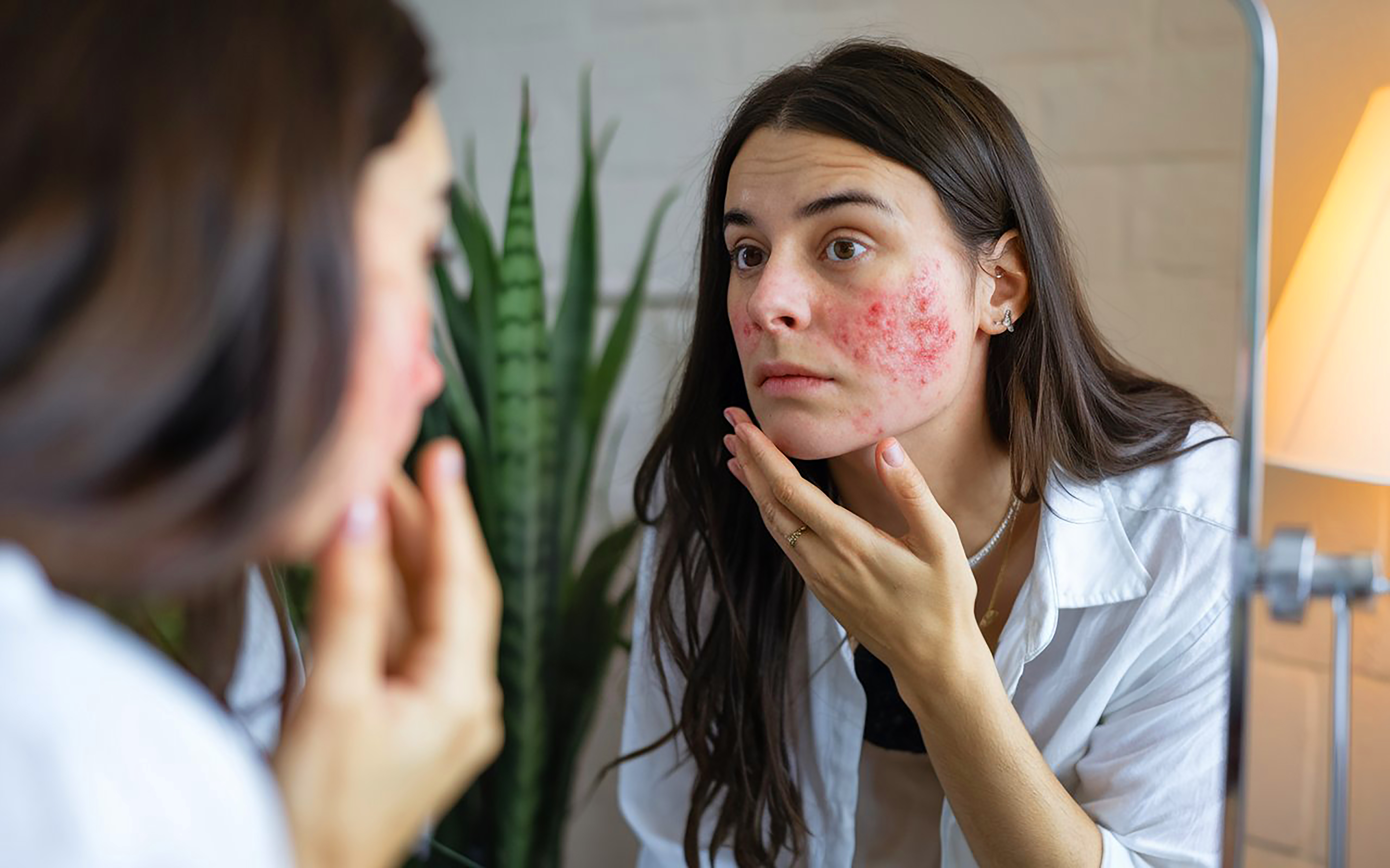 How Homeopathy Helps Chronic Skin Disorders